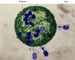 Bacteriophage viruses attacking a bacterium