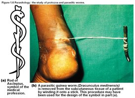 Parasitic guinea worm removal