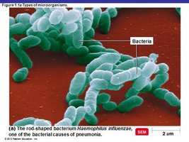 SEM image of rod-shaped bacteria