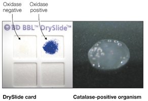 Oxidase and catalase test results