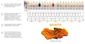 API test strip system