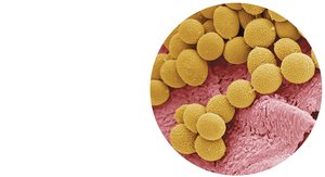 SEM of athlete's foot fungal spores