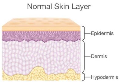 Diagram of normal skin layers