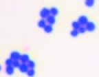 Gram-positive cell wall