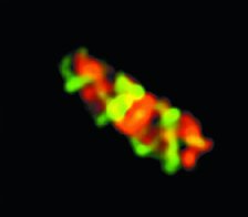 Prokaryotic cytoskeleton