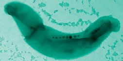 Magnetosomes in prokaryotes