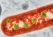 Carboxysomes in prokaryotes