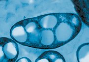 Inclusion bodies in prokaryotes