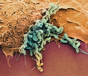 Pleomorphic Helicobacter pylori