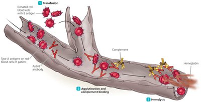Events Leading to Hemolysis in Transfusion Reaction