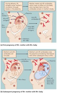 Events in the Development of Hemolytic Disease of the Newborn