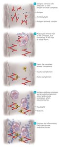 Mechanism of Type III Hypersensitivity