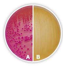 MacConkey agar showing lactose fermenters and non-fermenters