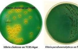 Vibrio species on TCBS agar