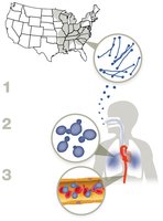 Histoplasmosis infection process and US distribution