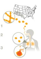 Blastomycosis infection process and US distribution