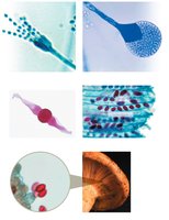 Types of fungal spores: conidiospores and sporangiospores