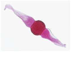 Zygospore (sexual spore)