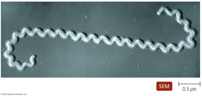 SEM image of a spirochete
