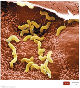 SEM image of Helicobacter pylori colonizing stomach lining