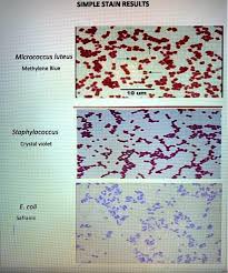 Simple stain results for Micrococcus luteus, Staphylococcus, and E. coli