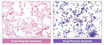 Gram stain results: Gram-negative (pink) and Gram-positive (purple) bacteria