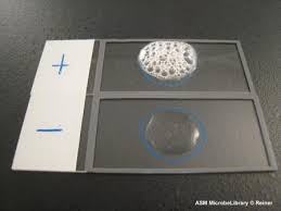 Catalase test: positive (bubbles) and negative (no bubbles)