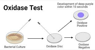 Oxidase test: positive (purple) and negative (no color change)