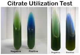 Citrate utilization test: positive (blue) and negative (green)