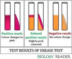 Urease test: positive (pink) and negative (yellow/orange)
