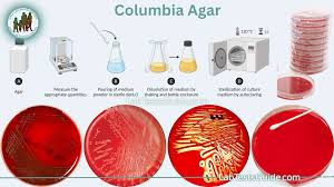 Columbia CNA agar preparation and hemolysis patterns