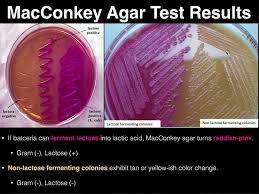 MacConkey agar: lactose fermenting (pink) and non-fermenting (colorless) colonies