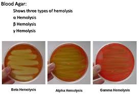 Blood agar: beta, alpha, and gamma hemolysis patterns