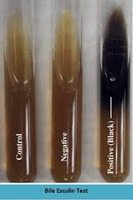 Bile esculin test: positive (black) and negative (no blackening)