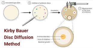 Kirby-Bauer method: steps and measurement of inhibition zones