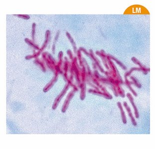 Acid-fast stained Mycobacterium tuberculosis