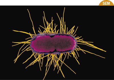 Fimbriae on a bacterial cell