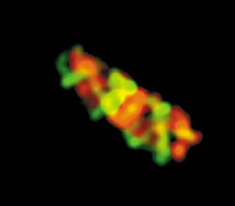 Prokaryotic cytoskeleton