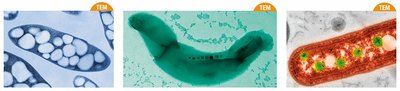 Types of inclusion bodies in prokaryotes