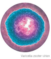 Varicella-zoster virion