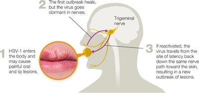 HSV-1 infection and latency diagram