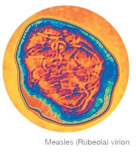 Measles (Rubeola) virion