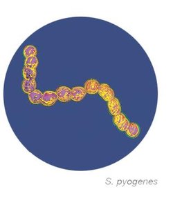 S. pyogenes (beads-on-a-string appearance)
