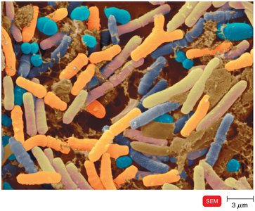 SEM image of diverse intestinal bacteria