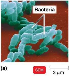 SEM image of bacteria