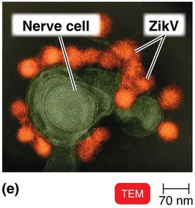 TEM image of Zika virus particles on a nerve cell