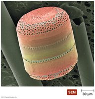 Diatom Coscinodiscus