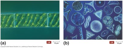 LM of Spirogyra and diatoms (algae)