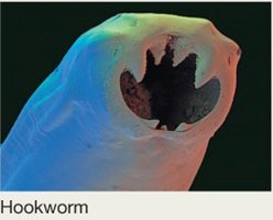 Micrograph of hookworm, a parasitic helminth