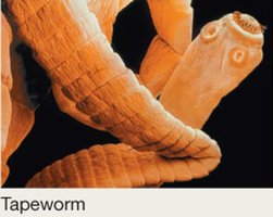 Micrograph of tapeworm, a parasitic helminth